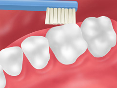 歯みがき指導